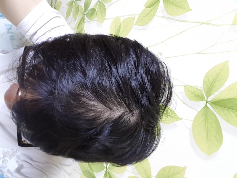 20170330_214649.jpg