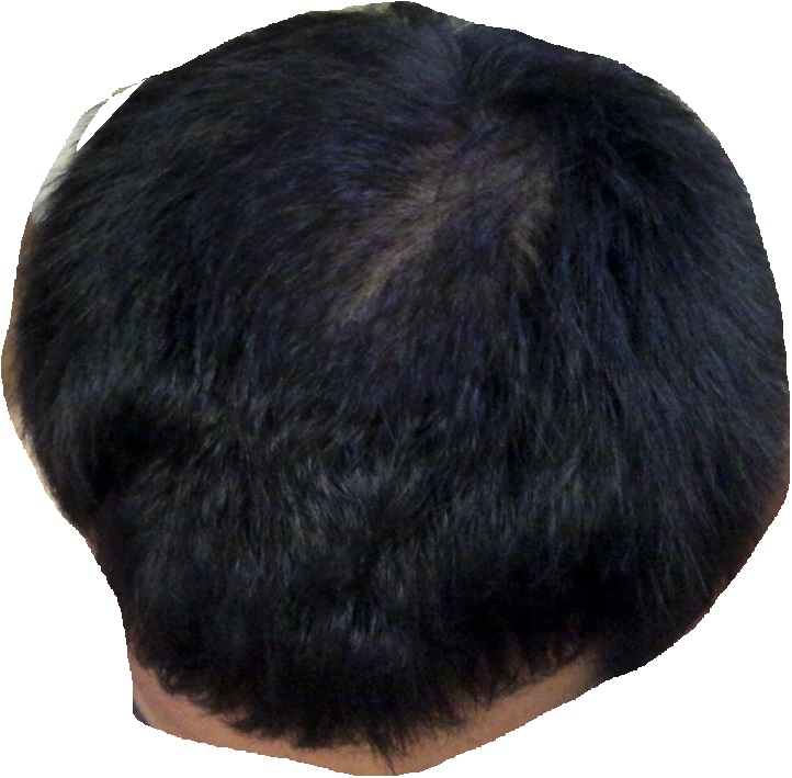 7234324.jpg