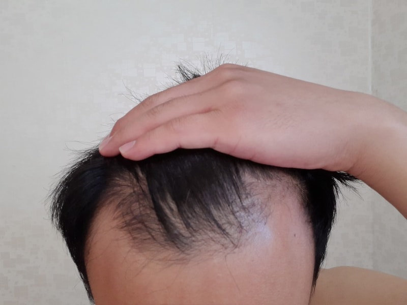 190917 앞머리.jpg