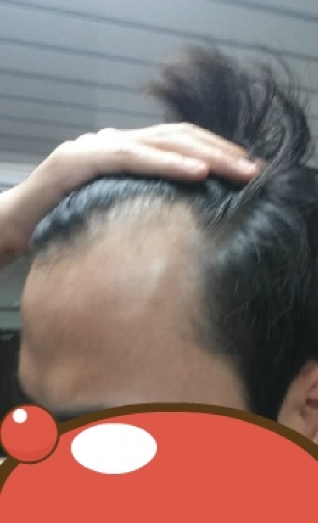 이마깐 좌측.jpg