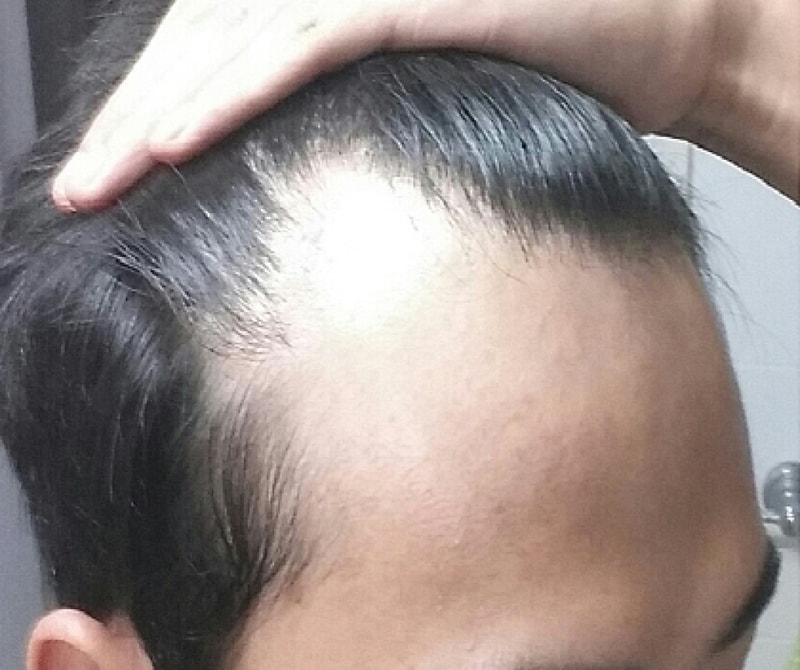 좌측.jpg
