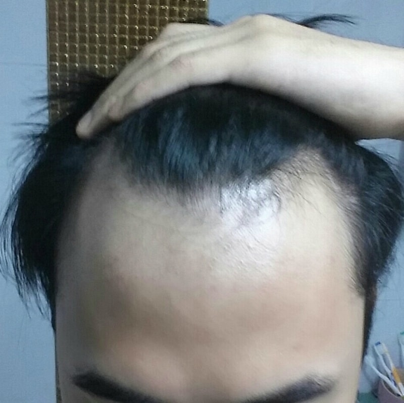 정면.jpg