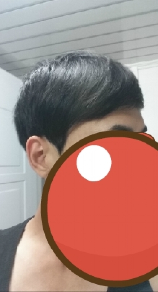 머리내렸을때 우측.jpg