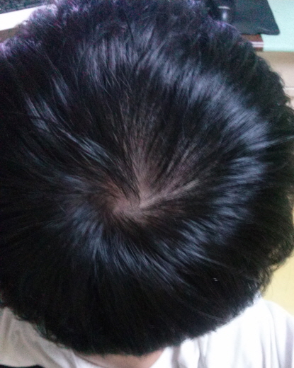 사본 -20150419_213716.jpg