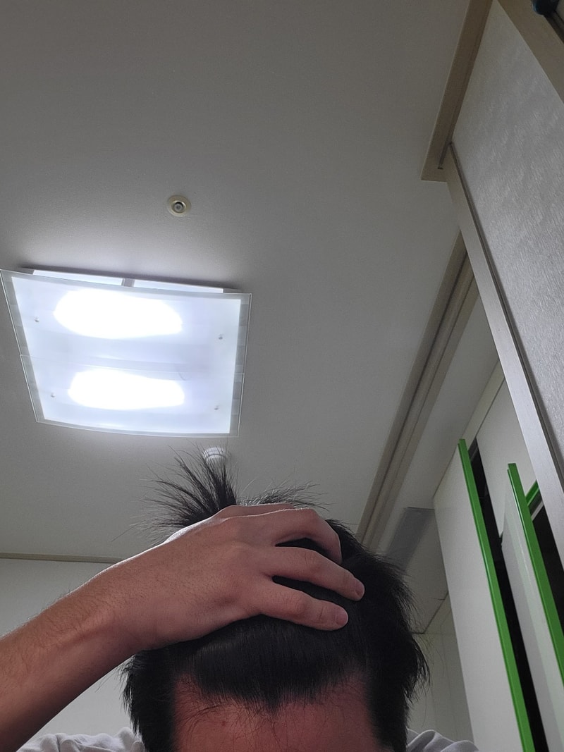 탈모1.jpg