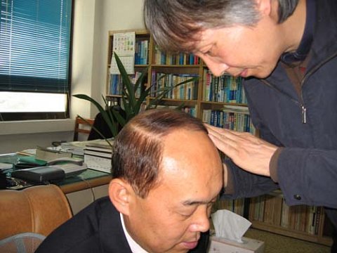 발모.jpg