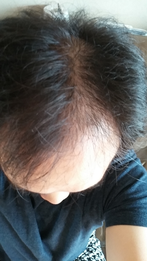 20140713_114110.jpg