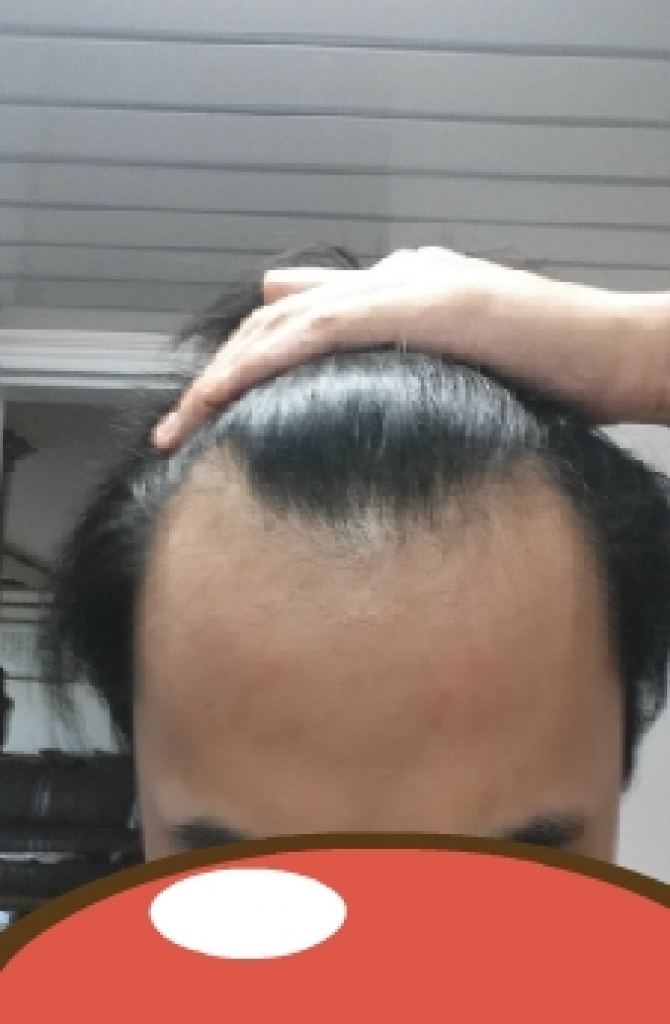 이마깐 정면.jpg