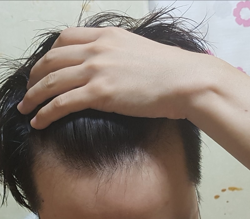 20170824_003838.jpg