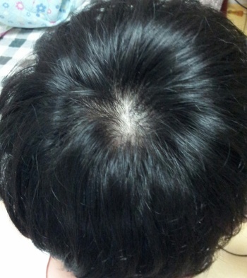 정수리.jpg