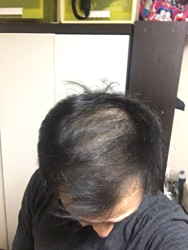 한의원 치료 전