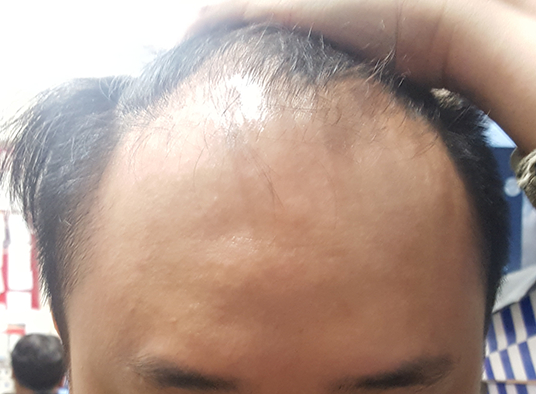 BeautyPlus_20170418131710_save.jpg