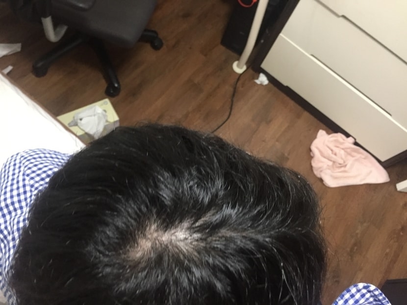 약복용전