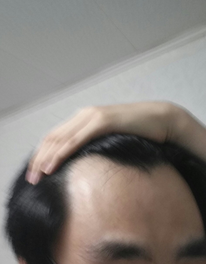20170118_174420-1.jpg
