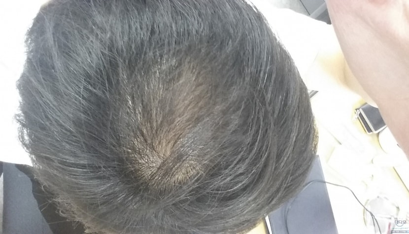 6개월전