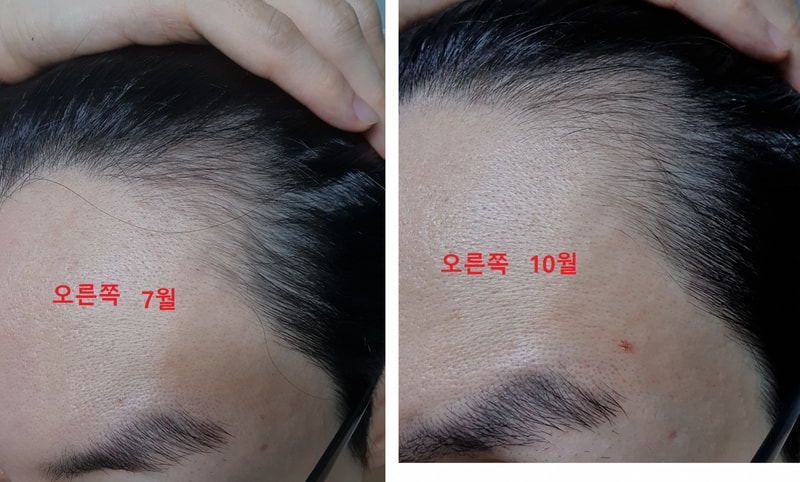 오른쪽 10월.jpg
