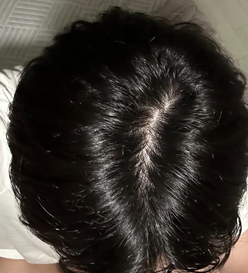 1년전