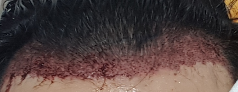 20170906_203135.png