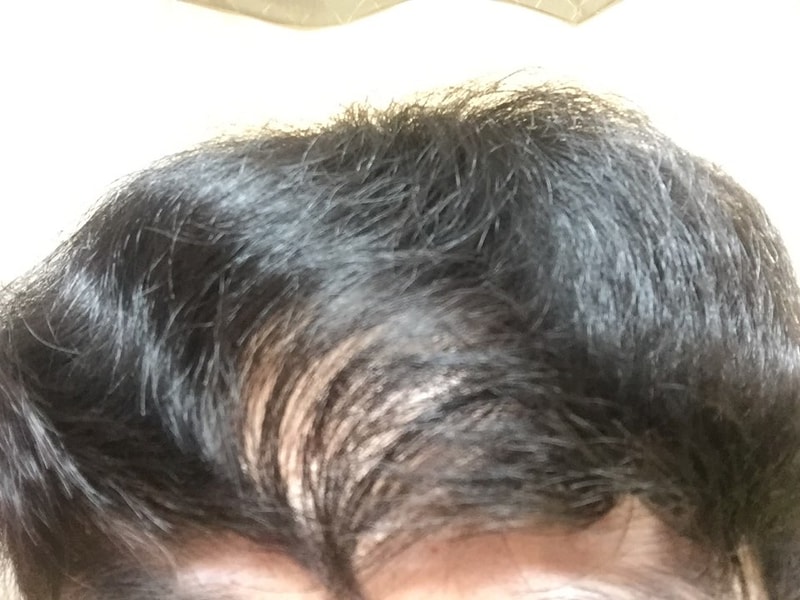 17년 3월 최근(머리 말린후).jpg