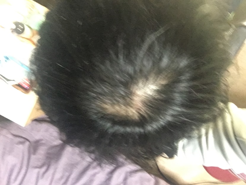 복용 20일차
