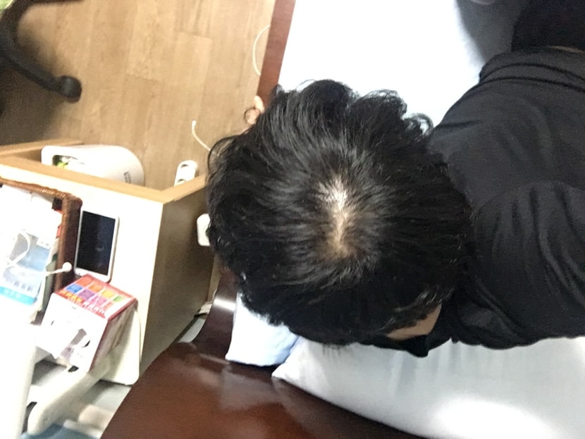복용 30일차