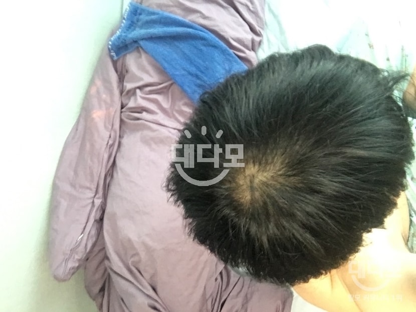 복용 30일차