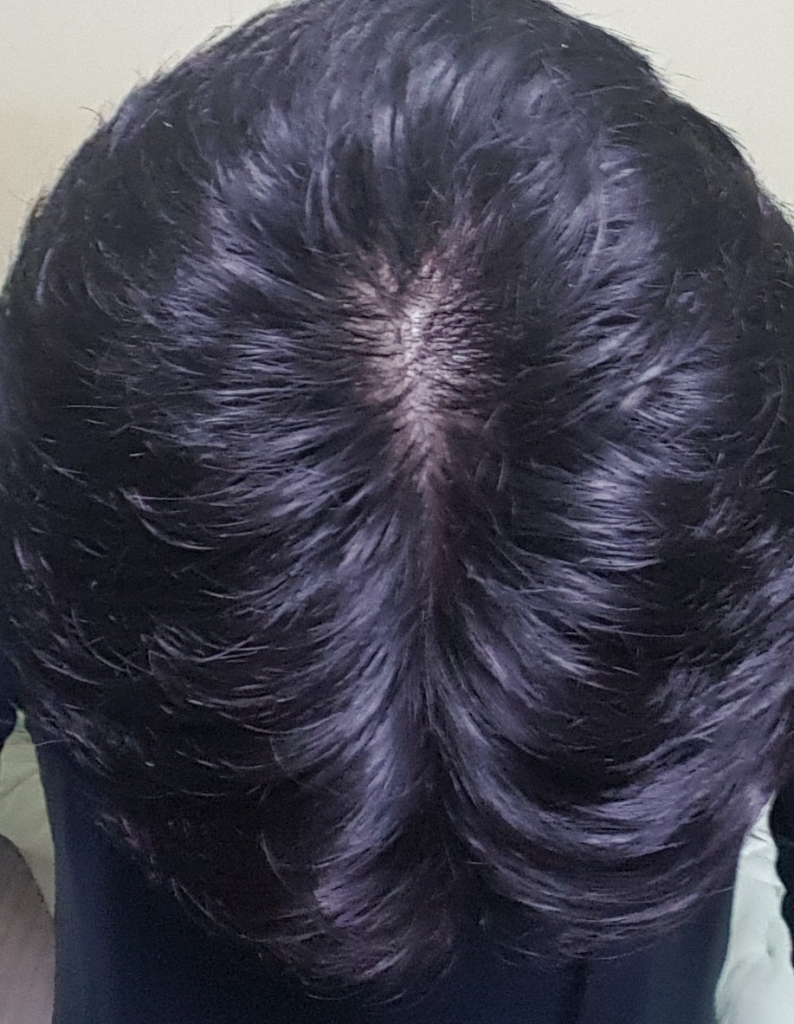 20180123_223233.jpg