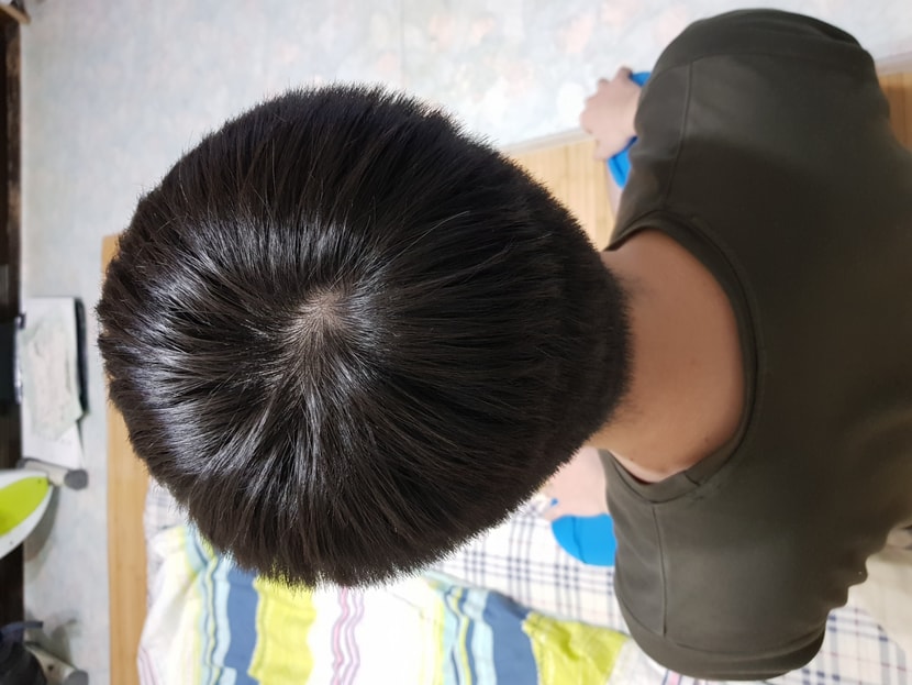 23년 1월 27일 정수리(뒤에서 촬영)