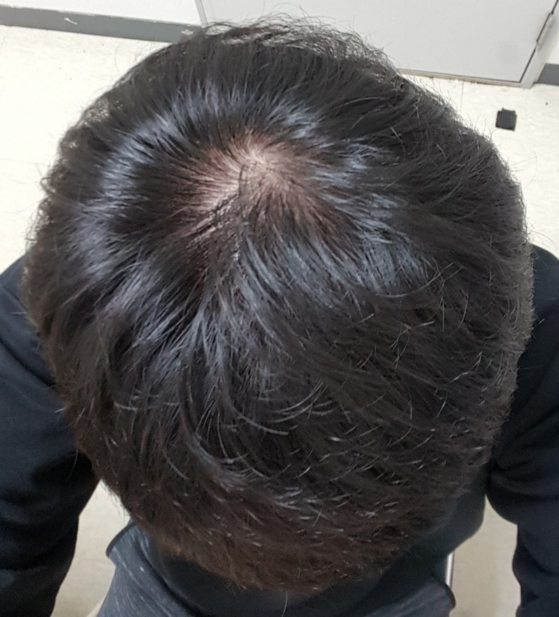 20180309_103511.jpg