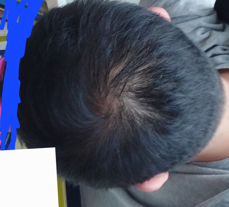 1000000041.jpg