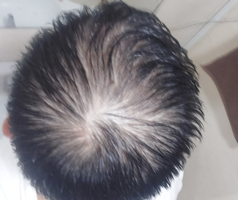 1000000023.jpg