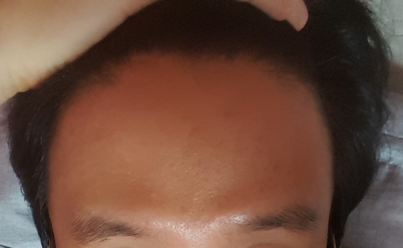 정면
