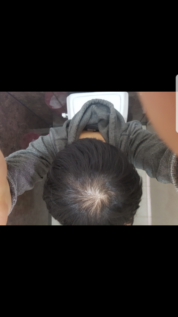 Screenshot_20180320-161138.png