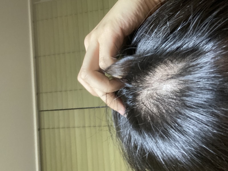 2793DB93-2A4E-4297-B188-4DD107D35127.jpeg