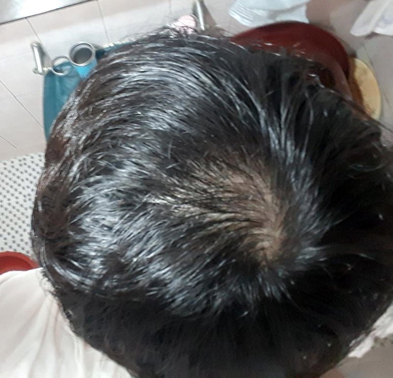 정수리.jpg