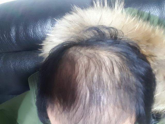 20170219_210354.jpg