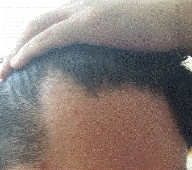 이마.gif