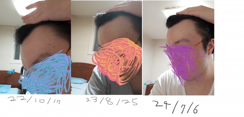 왼쪽비교 최신.jpg