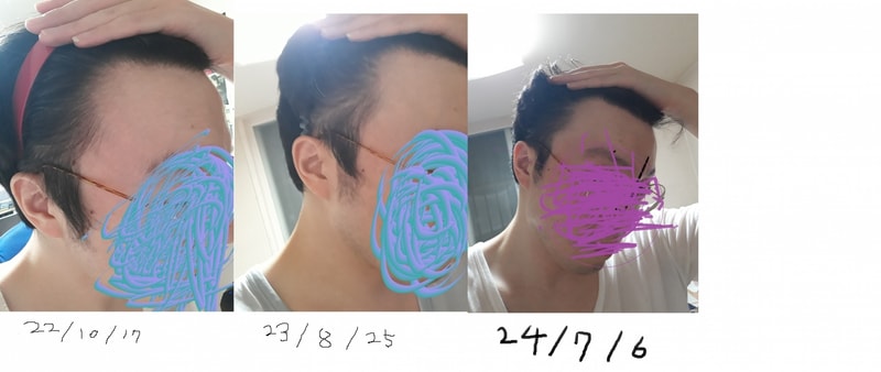 오른쪽비교 최신.jpg