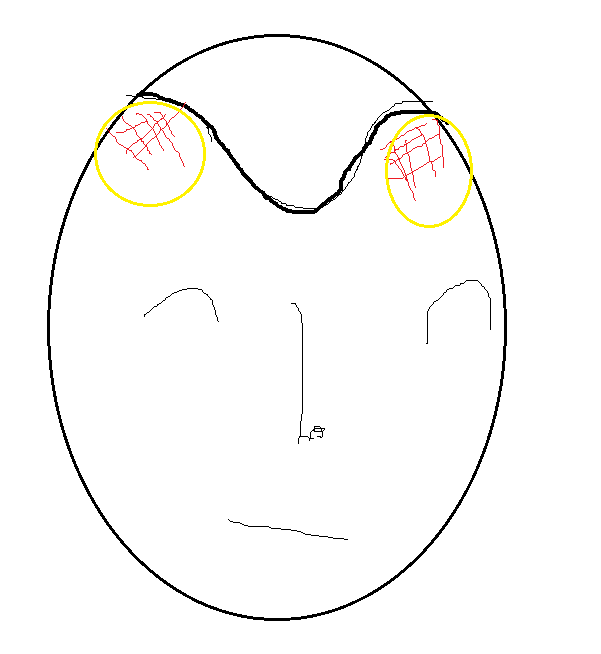 111.png