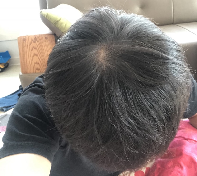 19. 2. 2. 복약3개월