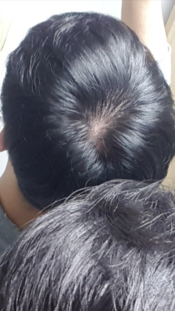 Screenshot_20180616-191726_Gallery.jpg