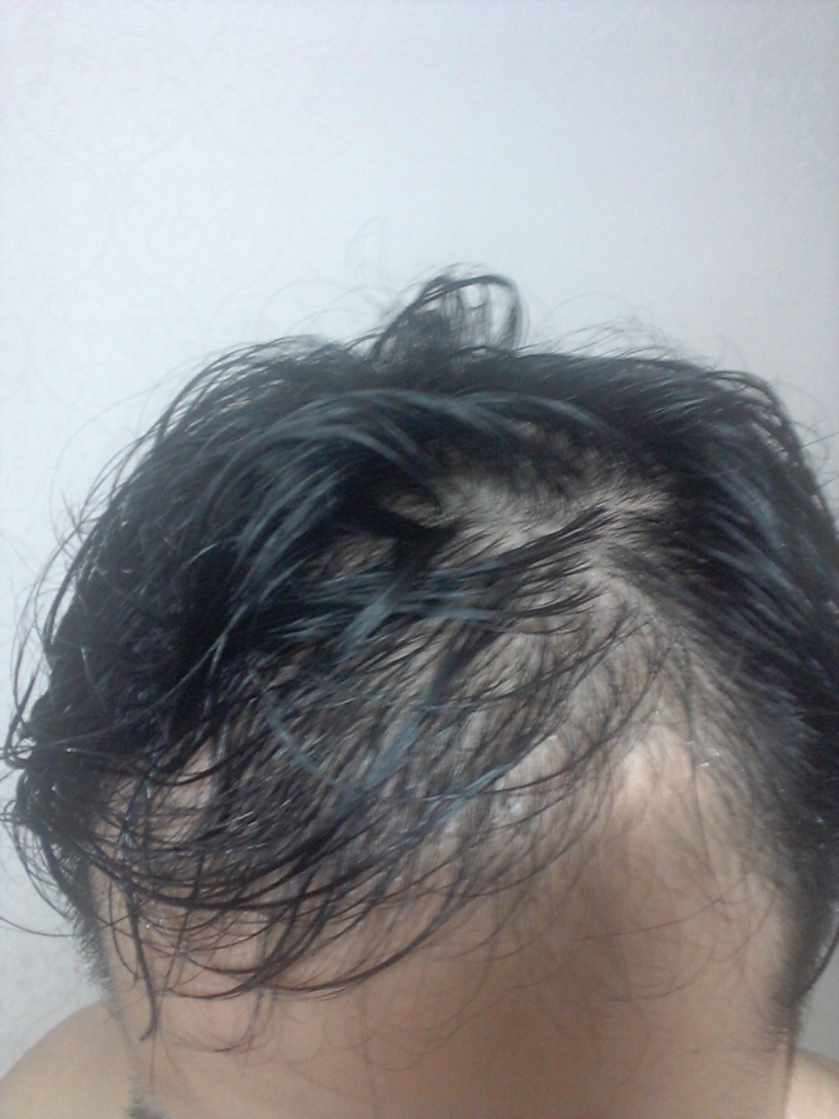 20140826_211641.jpg