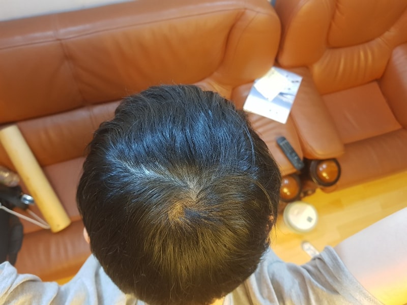 4개월후.jpg