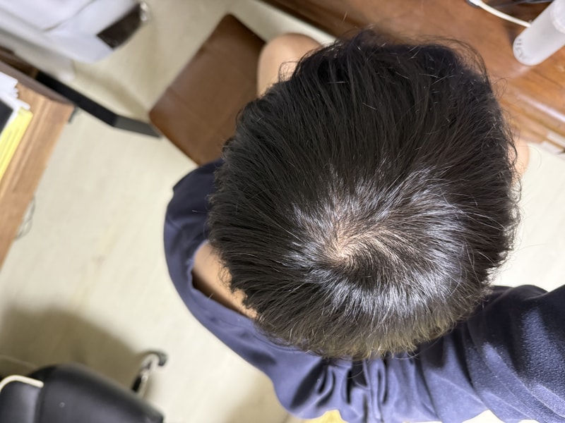 정수리 어때보이나요??
