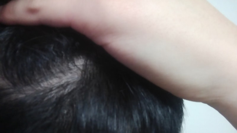 20170206_193824.jpg