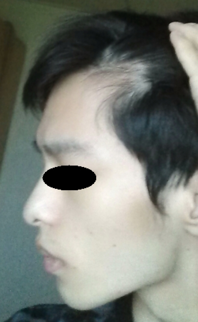 좌측.jpg