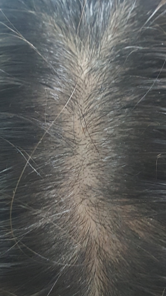 후