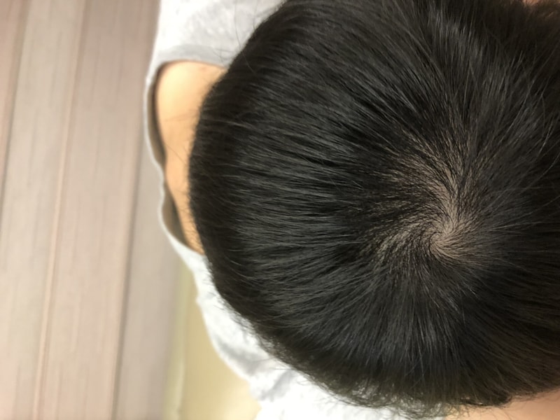 A125AFFA-70FE-4413-AF6E-3D33B580956A.jpeg