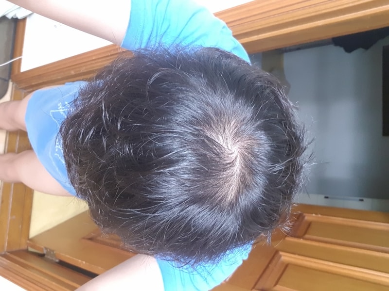 20170821_201306.jpg